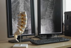Chandler Chiropractic in Scottsdale and Chandler take state of the art x-rays.